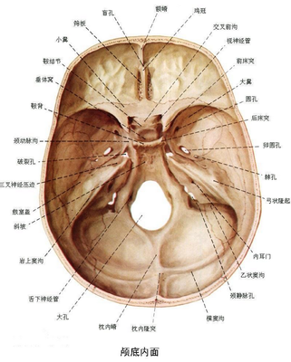 颅中窝的孔裂图片